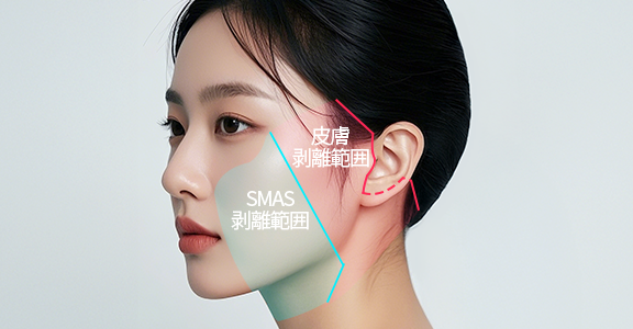 안면거상+목거상