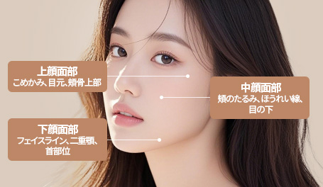 内視鏡ミニリフト