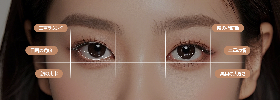 チャミン二重手術