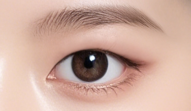 固定が弱い場合