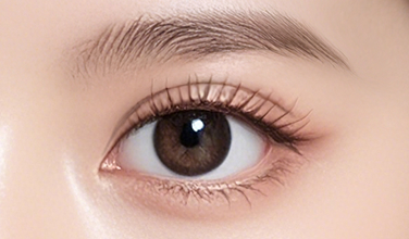 固定が強度な場合